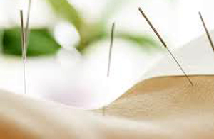 Acupuncture